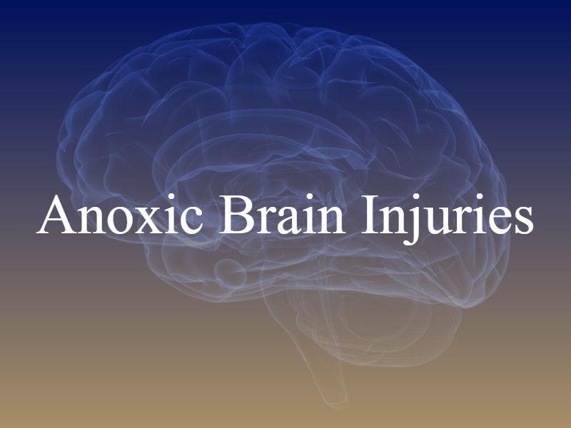Anoxic Brain Injuries