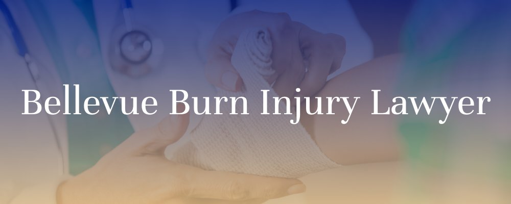 Bellevue Burn Injury Lawyer