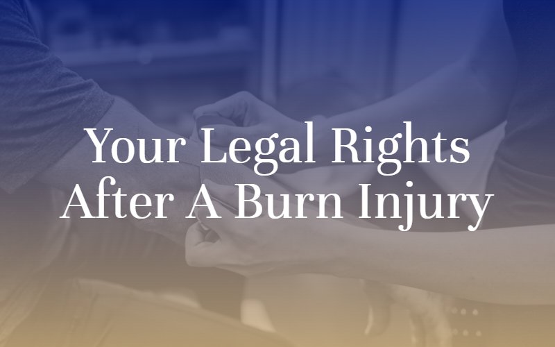 Your Legal Rights After a Burn Injury