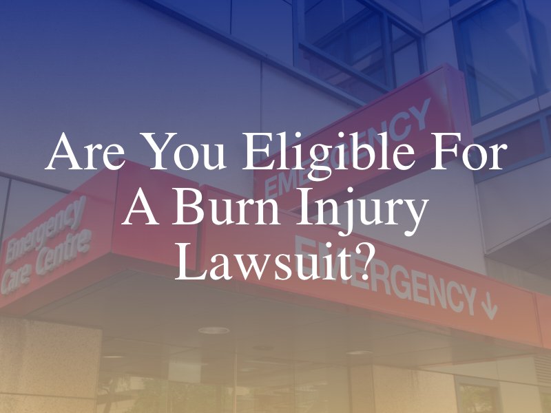 Are you eligible for a burn injury lawsuit?